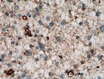 CPT1C Antibody in Immunohistochemistry (Paraffin) (IHC (P))