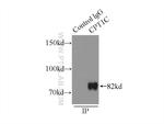 CPT1C Antibody in Immunoprecipitation (IP)