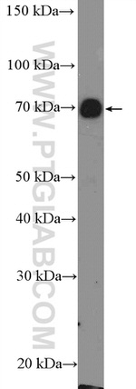 CPT1C Antibody in Western Blot (WB)