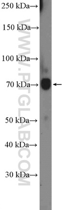 CPT1C Antibody in Western Blot (WB)