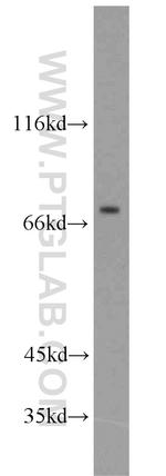 CPT1C Antibody in Western Blot (WB)