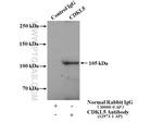 CDKL5 Antibody in Immunoprecipitation (IP)