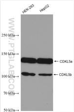 CDKL5 Antibody in Western Blot (WB)