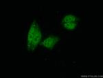 CDC5L Antibody in Immunocytochemistry (ICC/IF)