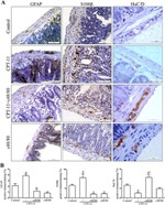 HuC/HuD Antibody in Immunohistochemistry (IHC)