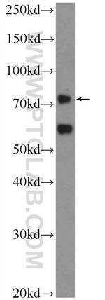 PASD1 Antibody in Western Blot (WB)