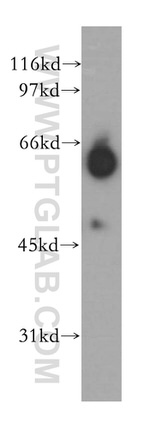GABRA4 Antibody in Western Blot (WB)