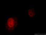NFYA Antibody in Immunocytochemistry (ICC/IF)