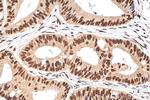 NFYA Antibody in Immunohistochemistry (Paraffin) (IHC (P))