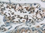 TPTE Antibody in Immunohistochemistry (Paraffin) (IHC (P))