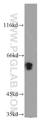 TPTE Antibody in Western Blot (WB)
