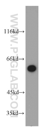 TPTE Antibody in Western Blot (WB)