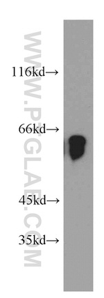 TPTE Antibody in Western Blot (WB)