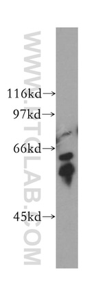 TPTE Antibody in Western Blot (WB)