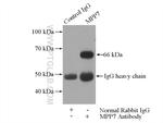 MPP7 Antibody in Immunoprecipitation (IP)