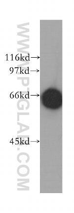 MPP7 Antibody in Western Blot (WB)