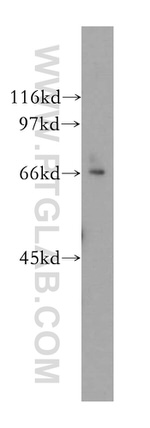 MPP7 Antibody in Western Blot (WB)