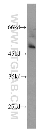 PHD1 Antibody in Western Blot (WB)