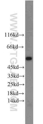 PHD1 Antibody in Western Blot (WB)