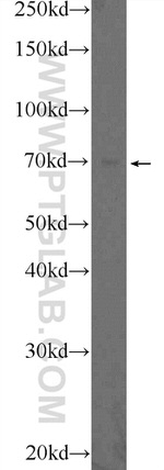 BNIP3L Antibody in Western Blot (WB)