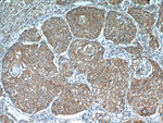 PGRMC1 Antibody in Immunohistochemistry (Paraffin) (IHC (P))