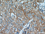 PGRMC1 Antibody in Immunohistochemistry (Paraffin) (IHC (P))