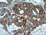 PGRMC1 Antibody in Immunohistochemistry (Paraffin) (IHC (P))