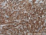 PGRMC1 Antibody in Immunohistochemistry (Paraffin) (IHC (P))
