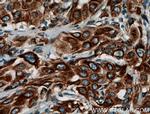PGRMC1 Antibody in Immunohistochemistry (Paraffin) (IHC (P))