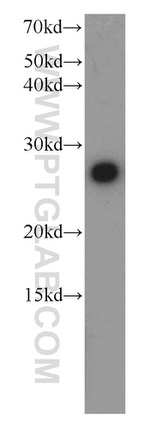 PGRMC1 Antibody in Western Blot (WB)
