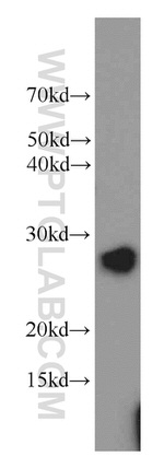 PGRMC1 Antibody in Western Blot (WB)