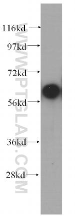 COASY Antibody in Western Blot (WB)