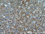 SIRT7 Antibody in Immunohistochemistry (Paraffin) (IHC (P))