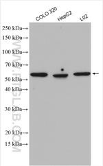 NEU4 Antibody in Western Blot (WB)