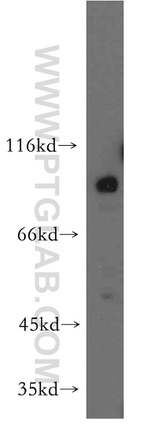 Ephrin B1 Antibody in Western Blot (WB)
