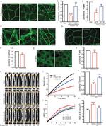GFP Antibody in Immunocytochemistry (ICC/IF)