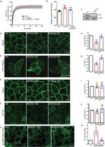 GFP Antibody in Immunocytochemistry (ICC/IF)
