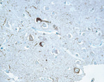 Tau Antibody in Immunohistochemistry (IHC)