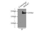 DOCK7 Antibody in Immunoprecipitation (IP)