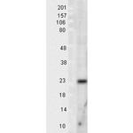 Superoxide dismutase (SOD) Mn Antibody in Western Blot (WB)