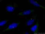 Ninein Antibody in Immunocytochemistry (ICC/IF)