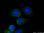 Ninein Antibody in Immunocytochemistry (ICC/IF)