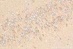 Ninein Antibody in Immunohistochemistry (Paraffin) (IHC (P))