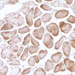 AMPK alpha 1 Antibody in Immunohistochemistry (IHC)