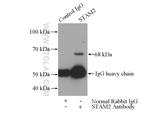 STAM2 Antibody in Immunoprecipitation (IP)