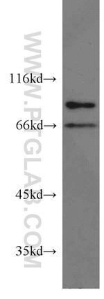 STAM2 Antibody in Western Blot (WB)