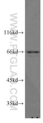 STAM2 Antibody in Western Blot (WB)