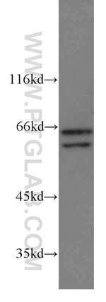 STAM2 Antibody in Western Blot (WB)