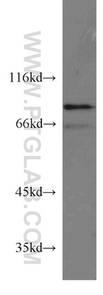 STAM2 Antibody in Western Blot (WB)