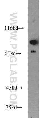 STAM2 Antibody in Western Blot (WB)
